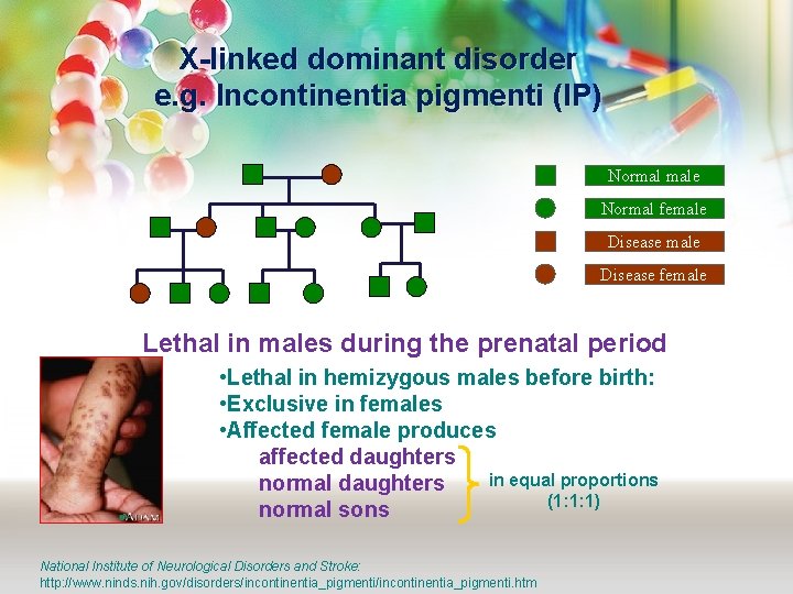 X-linked dominant disorder e. g. Incontinentia pigmenti (IP) Normal male Normal female Disease female
