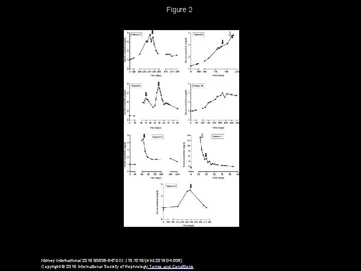 Figure 2 Kidney International 2016 90638 -647 DOI: (10. 1016/j. kint. 2016. 04. 008)