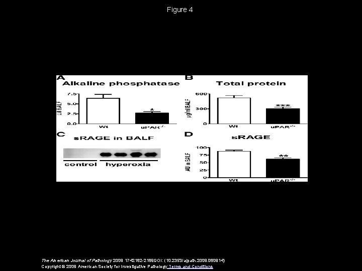 Figure 4 The American Journal of Pathology 2009 1742182 -2189 DOI: (10. 2353/ajpath. 2009.