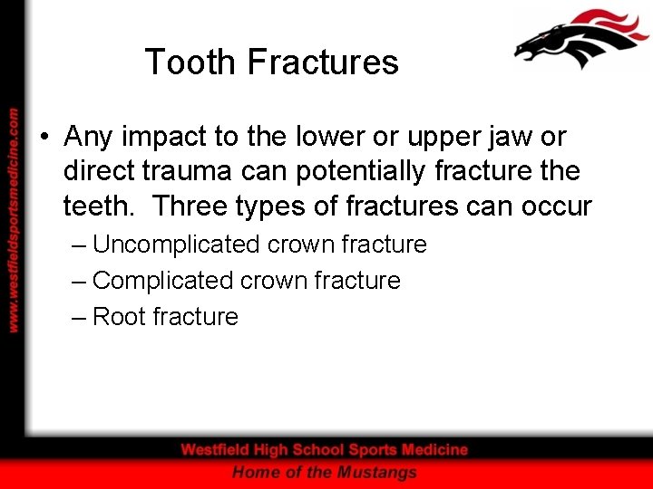 Tooth Fractures • Any impact to the lower or upper jaw or direct trauma