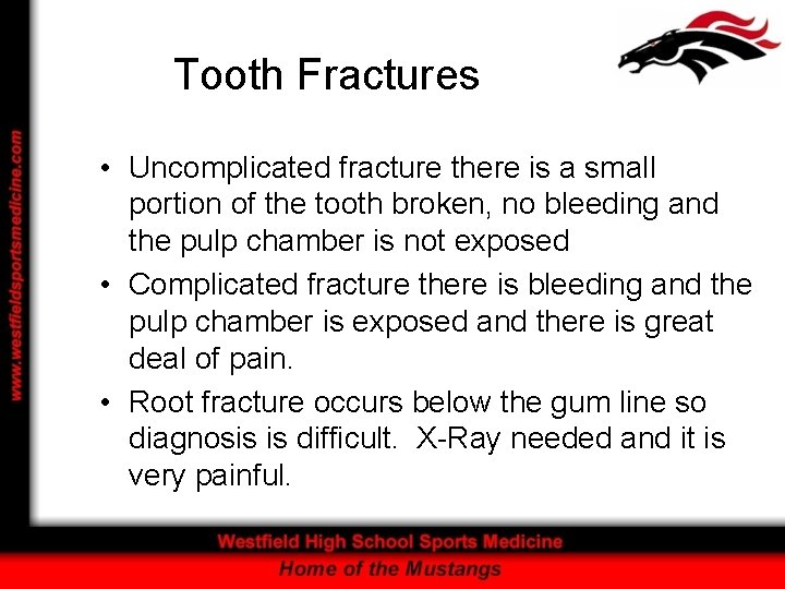 Tooth Fractures • Uncomplicated fracture there is a small portion of the tooth broken,