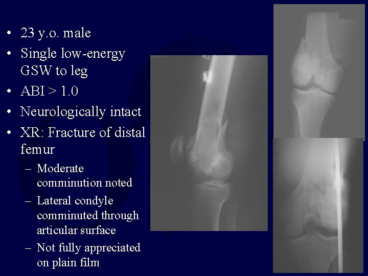 • 23 y. o. male • Single low-energy GSW to leg • ABI • 23 y. o. male • Single low-energy GSW to leg • ABI