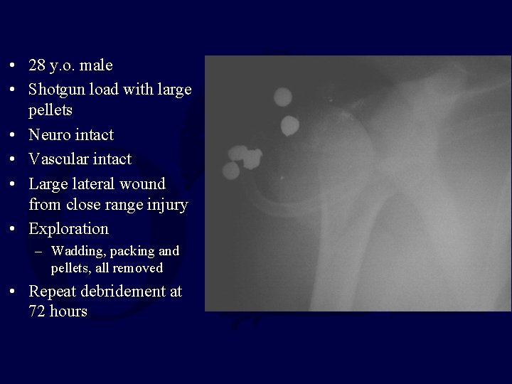 • 28 y. o. male • Shotgun load with large pellets • Neuro • 28 y. o. male • Shotgun load with large pellets • Neuro
