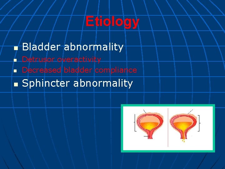 Etiology n Bladder abnormality n Detrusor overactivity Decreased bladder compliance n Sphincter abnormality n