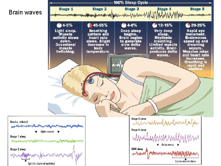 Brain waves 23 