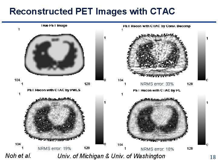 Reconstructed PET Images with CTAC NRMS error: 33% NRMS error: 19% Noh et al.