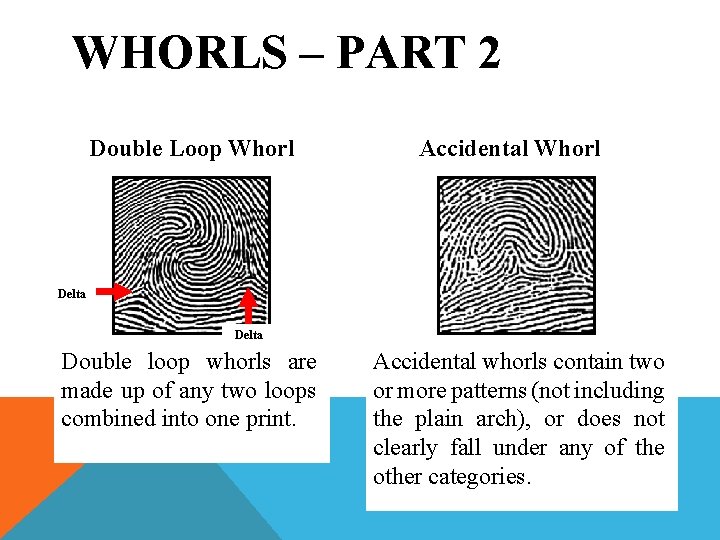 WHORLS – PART 2 Double Loop Whorl Accidental Whorl Delta Double loop whorls are