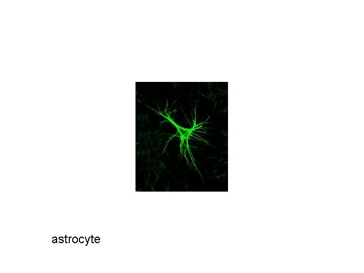 astrocyte 