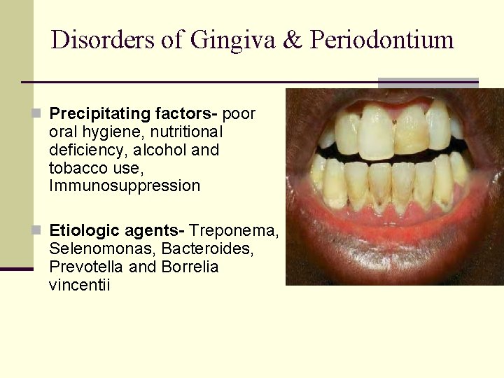 Disorders of Gingiva & Periodontium n Precipitating factors- poor oral hygiene, nutritional deficiency, alcohol