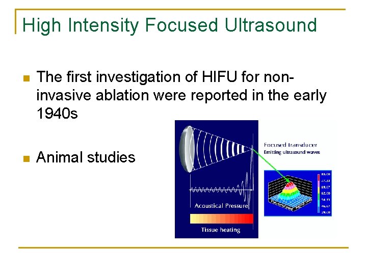 High Intensity Focused Ultrasound n The first investigation of HIFU for noninvasive ablation were