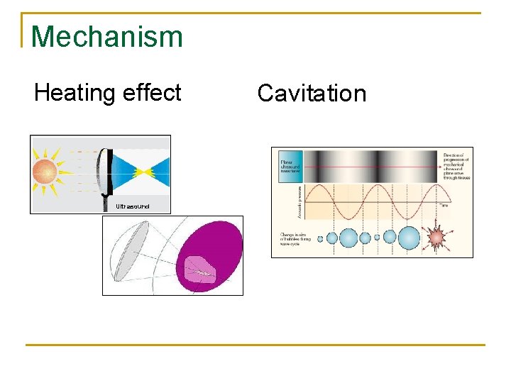 Mechanism Heating effect Ultrasound Cavitation 