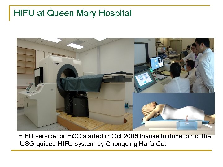 HIFU at Queen Mary Hospital HIFU service for HCC started in Oct 2006 thanks