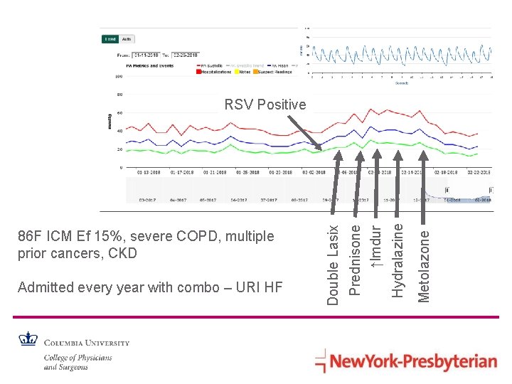 Metolazone Hydralazine Admitted every year with combo – URI HF Prednisone ↑Imdur 86 F