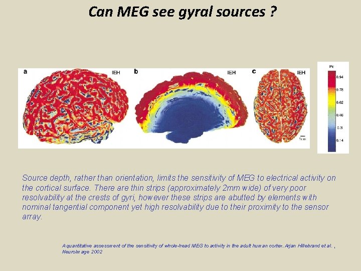 Can MEG see gyral sources ? Source depth, rather than orientation, limits the sensitivity