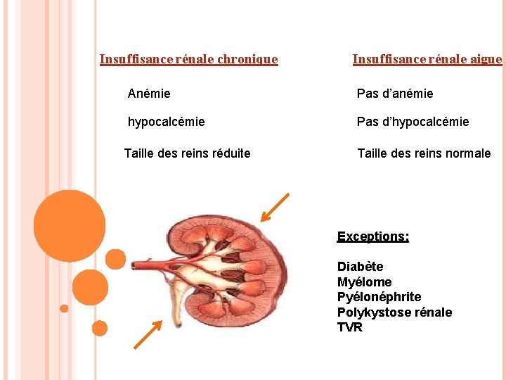 Insuffisance rénale chronique Insuffisance rénale aigue Anémie Pas d’anémie hypocalcémie Pas d’hypocalcémie Taille des