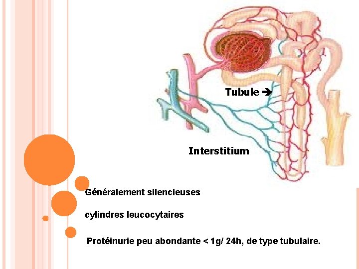 Tubule Interstitium Généralement silencieuses cylindres leucocytaires Protéinurie peu abondante < 1 g/ 24 h,