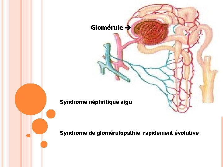 Glomérule Syndrome néphritique aigu Syndrome de glomérulopathie rapidement évolutive 
