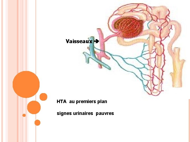 Vaisseaux HTA au premiers plan signes urinaires pauvres 