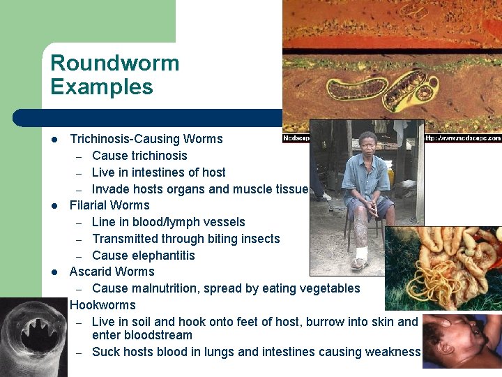 Roundworm Examples l l Trichinosis-Causing Worms – Cause trichinosis – Live in intestines of