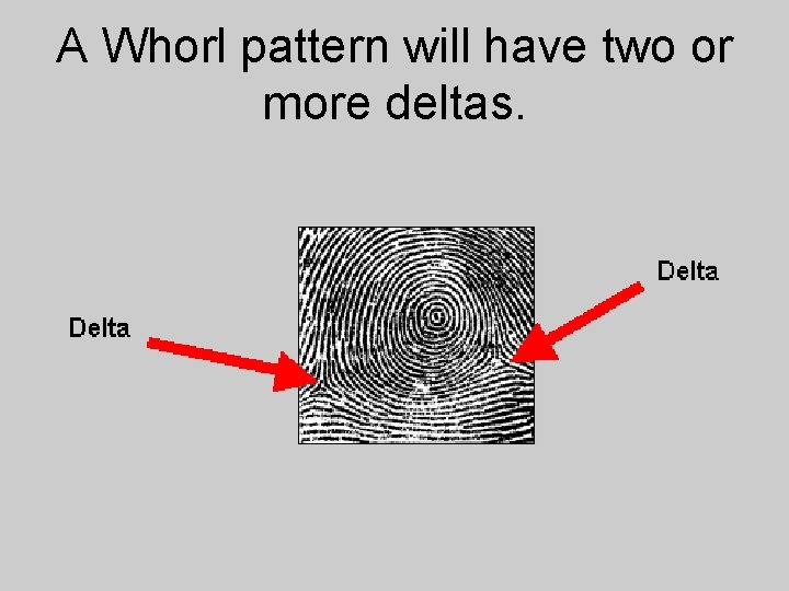 A Whorl pattern will have two or more deltas. 