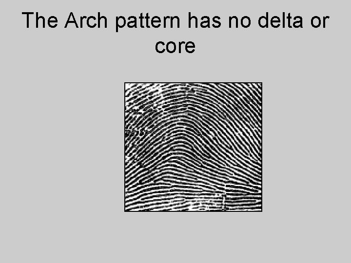 The Arch pattern has no delta or core 