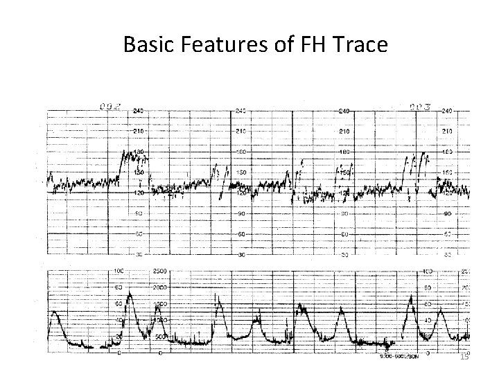 Basic Features of FH Trace 15 