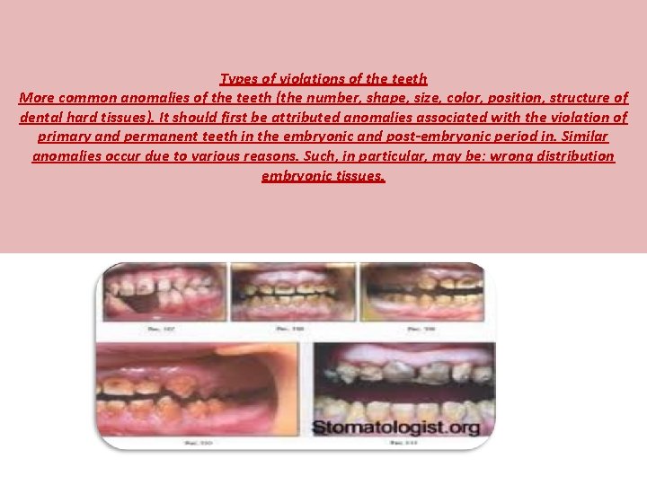 Types of violations of the teeth More common anomalies of the teeth (the number,