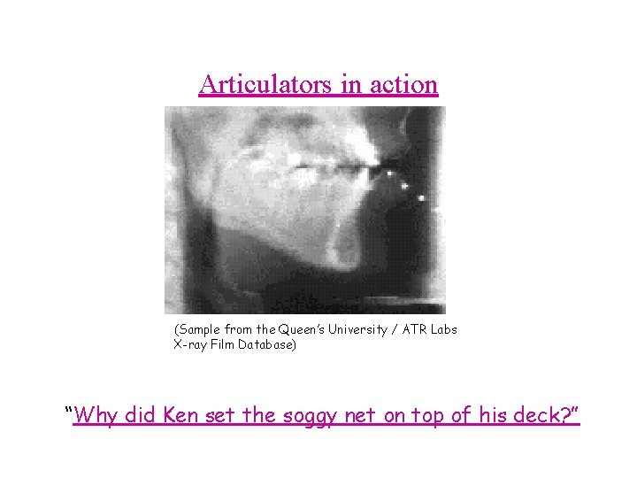 Articulators in action (Sample from the Queen’s University / ATR Labs X-ray Film Database)