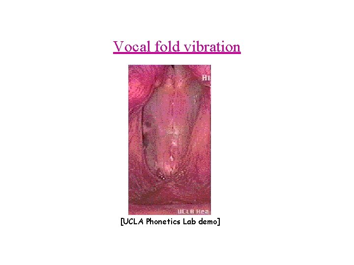 Vocal fold vibration [UCLA Phonetics Lab demo] 