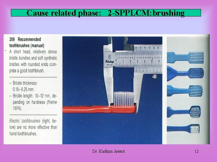 Cause related phase: 2 -SPPLCM: brushing Dr. Kadhim Jawad 12 Cause related phase: 2 -SPPLCM: brushing Dr. Kadhim Jawad 12
