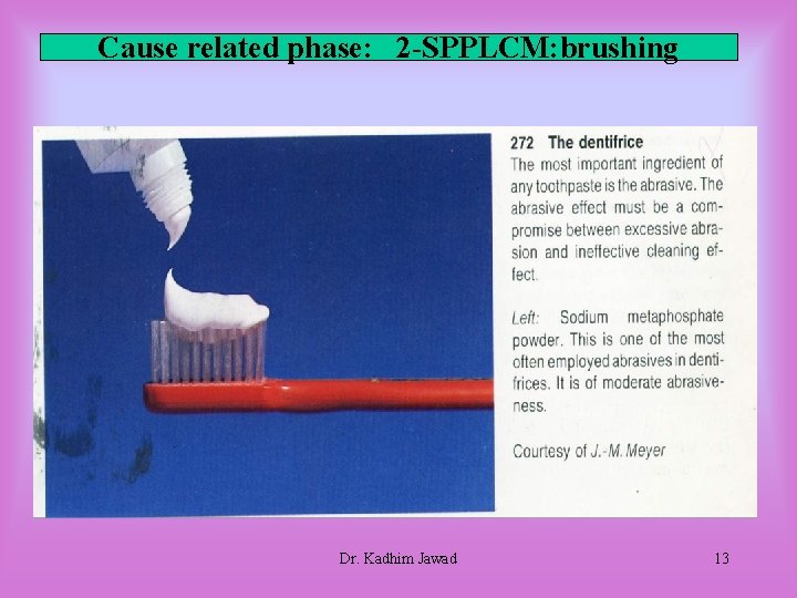 Cause related phase: 2 -SPPLCM: brushing Dr. Kadhim Jawad 13 Cause related phase: 2 -SPPLCM: brushing Dr. Kadhim Jawad 13