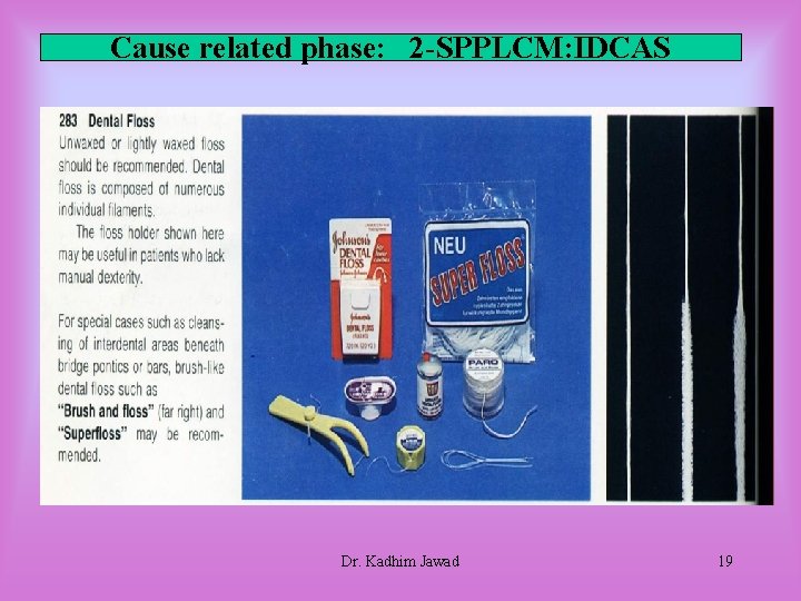 Cause related phase: 2 -SPPLCM: IDCAS Dr. Kadhim Jawad 19 Cause related phase: 2 -SPPLCM: IDCAS Dr. Kadhim Jawad 19