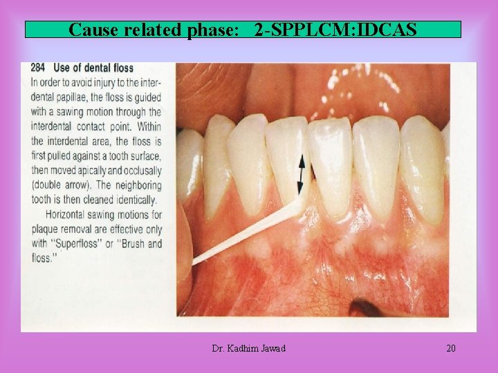 Cause related phase: 2 -SPPLCM: IDCAS Dr. Kadhim Jawad 20 Cause related phase: 2 -SPPLCM: IDCAS Dr. Kadhim Jawad 20