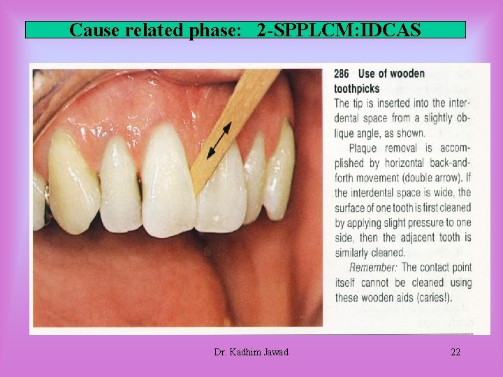 Cause related phase: 2 -SPPLCM: IDCAS Dr. Kadhim Jawad 22 Cause related phase: 2 -SPPLCM: IDCAS Dr. Kadhim Jawad 22