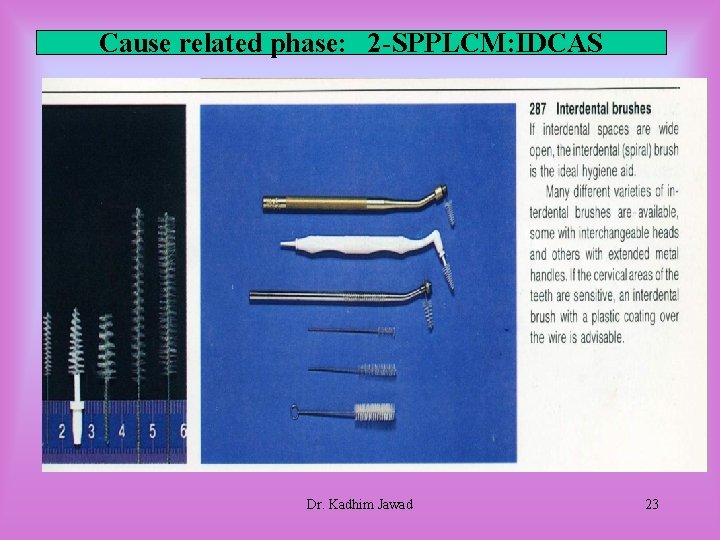 Cause related phase: 2 -SPPLCM: IDCAS Dr. Kadhim Jawad 23 Cause related phase: 2 -SPPLCM: IDCAS Dr. Kadhim Jawad 23