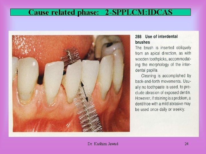 Cause related phase: 2 -SPPLCM: IDCAS Dr. Kadhim Jawad 24 Cause related phase: 2 -SPPLCM: IDCAS Dr. Kadhim Jawad 24