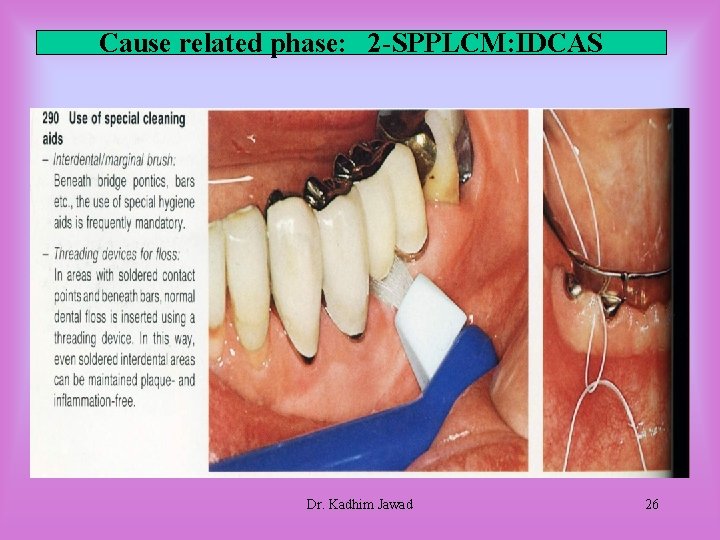 Cause related phase: 2 -SPPLCM: IDCAS Dr. Kadhim Jawad 26 Cause related phase: 2 -SPPLCM: IDCAS Dr. Kadhim Jawad 26