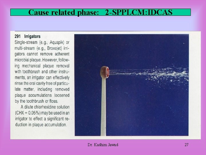 Cause related phase: 2 -SPPLCM: IDCAS Dr. Kadhim Jawad 27 Cause related phase: 2 -SPPLCM: IDCAS Dr. Kadhim Jawad 27