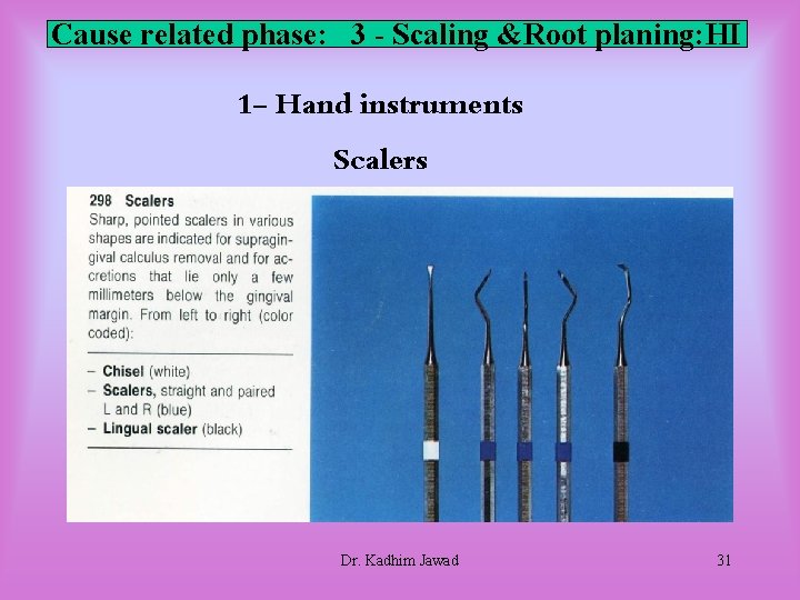 Cause related phase: 3 - Scaling &Root planing: HI 1 - Hand instruments Scalers Cause related phase: 3 - Scaling &Root planing: HI 1 - Hand instruments Scalers