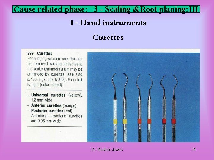 Cause related phase: 3 - Scaling &Root planing: HI 1 - Hand instruments Curettes Cause related phase: 3 - Scaling &Root planing: HI 1 - Hand instruments Curettes