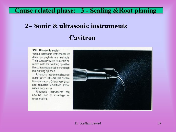 Cause related phase: 3 - Scaling &Root planing 2 - Sonic & ultrasonic instruments Cause related phase: 3 - Scaling &Root planing 2 - Sonic & ultrasonic instruments