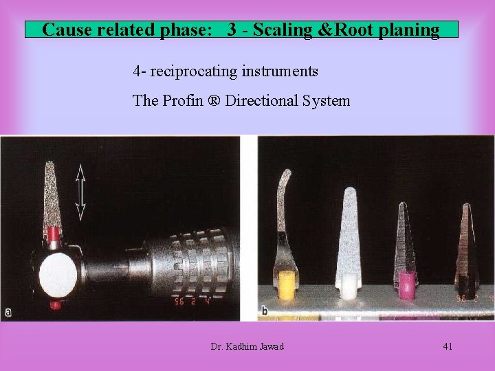 Cause related phase: 3 - Scaling &Root planing 4 - reciprocating instruments The Profin Cause related phase: 3 - Scaling &Root planing 4 - reciprocating instruments The Profin