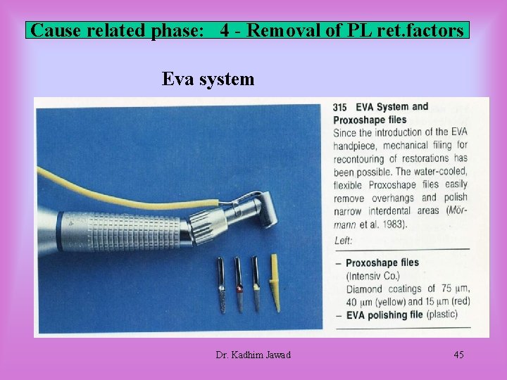Cause related phase: 4 - Removal of PL ret. factors Eva system Dr. Kadhim Cause related phase: 4 - Removal of PL ret. factors Eva system Dr. Kadhim