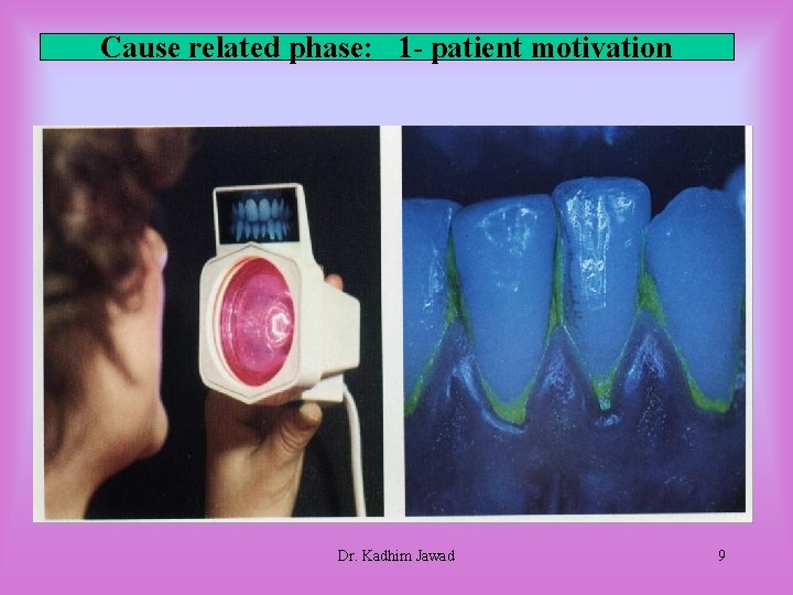 Cause related phase: 1 - patient motivation Dr. Kadhim Jawad 9 Cause related phase: 1 - patient motivation Dr. Kadhim Jawad 9
