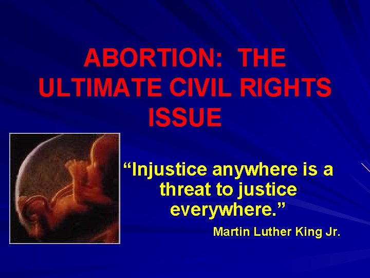 ABORTION: THE ULTIMATE CIVIL RIGHTS ISSUE “Injustice anywhere is a threat to justice everywhere.