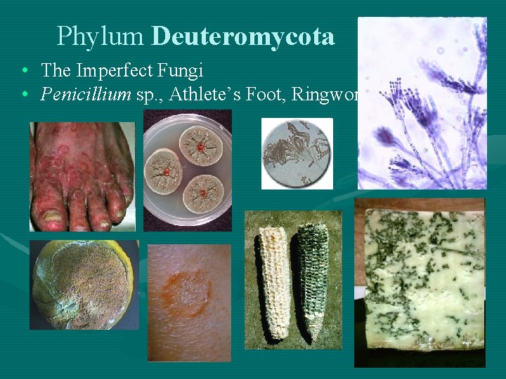 Phylum Deuteromycota • The Imperfect Fungi • Penicillium sp. , Athlete’s Foot, Ringworm 