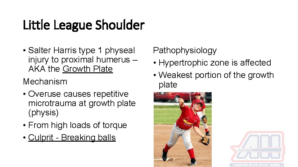 Little League Shoulder • Salter Harris type 1 physeal injury to proximal humerus –