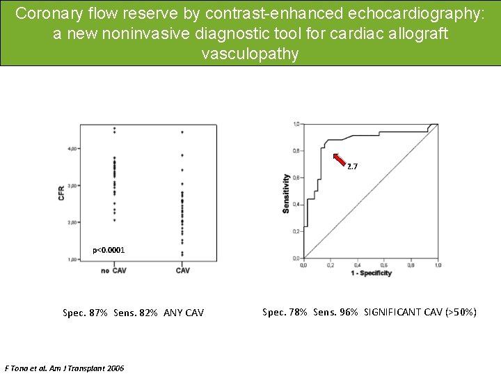 Coronary flow reserve by contrast-enhanced echocardiography: a new noninvasive diagnostic tool for cardiac allograft