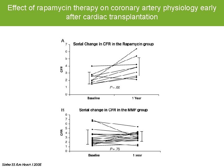 Effect of rapamycin therapy on coronary artery physiology early after cardiac transplantation Sinha SS