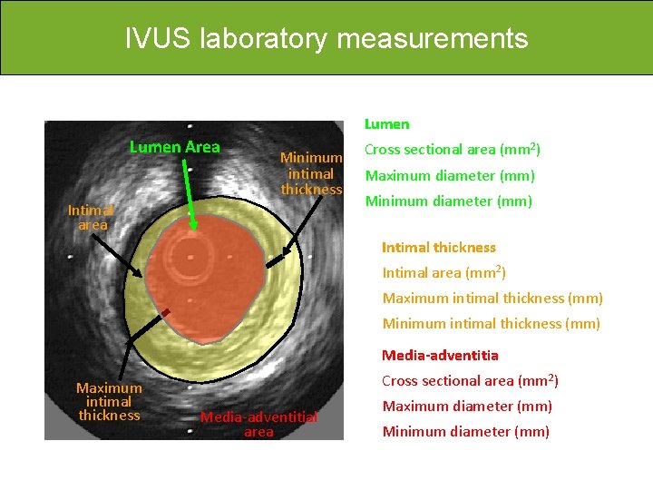 IVUS laboratory measurements Lumen Area Minimum intimal thickness Intimal area Cross sectional area (mm